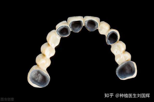 烂牙可以修复吗_牙烂到什么程度不能补_烂牙可以补牙吗