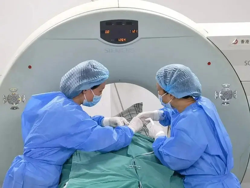鼻低温等离子消融手术_鼻子低温等离子消融术视频_鼻腔低温消融手术
